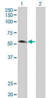 Western blot - Anti-TRIM31 antibody (AB67785)