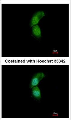 Immunocytochemistry/ Immunofluorescence - Anti-TRIM32 antibody (AB96612), expandable thumbnail