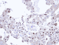 Immunohistochemistry (Formalin/PFA-fixed paraffin-embedded sections) - Anti-TRIM32 antibody (AB96612), expandable thumbnail
