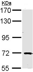 Western blot - Anti-TRIM32 antibody (AB96612), expandable thumbnail