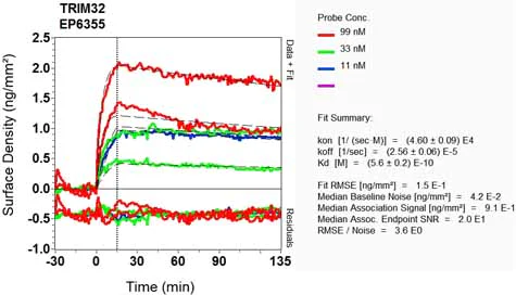 OI-RD Scanning - Anti-TRIM32 antibody [EP6355] (AB131223)