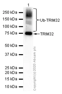 Western blot - Anti-TRIM32 antibody [EP6355] (AB131223)
