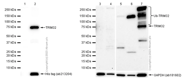 Western blot - Anti-TRIM32 antibody [EP6355] (AB131223)