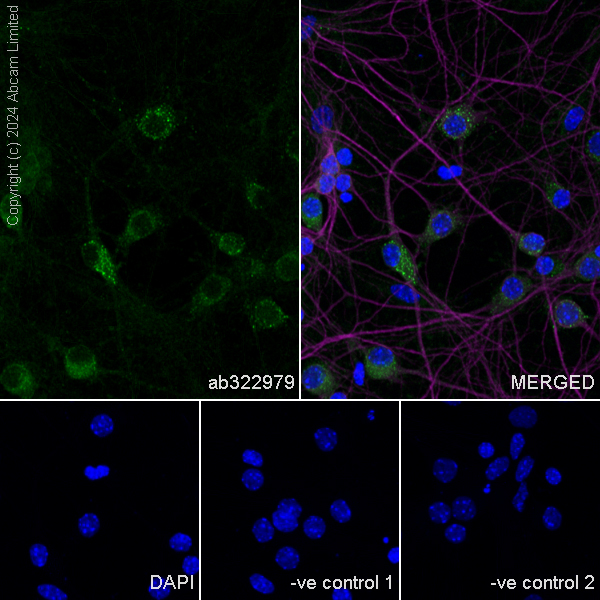Immunocytochemistry/ Immunofluorescence - Anti-TRIM32 antibody [EPR29683-521] (ab322979), expandable thumbnail