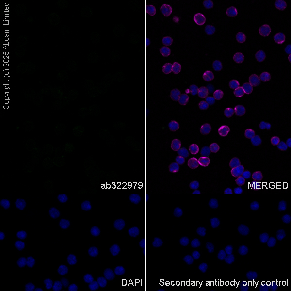 Immunocytochemistry/ Immunofluorescence - Anti-TRIM32 antibody [EPR29683-521] (ab322979), expandable thumbnail