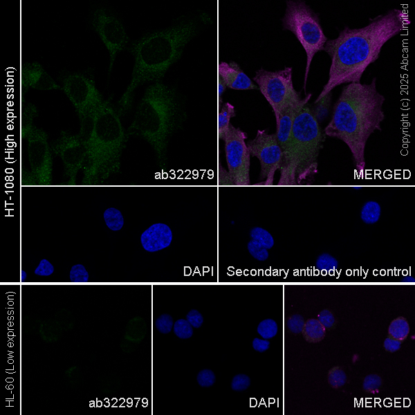 Immunocytochemistry/ Immunofluorescence - Anti-TRIM32 antibody [EPR29683-521] (ab322979), expandable thumbnail
