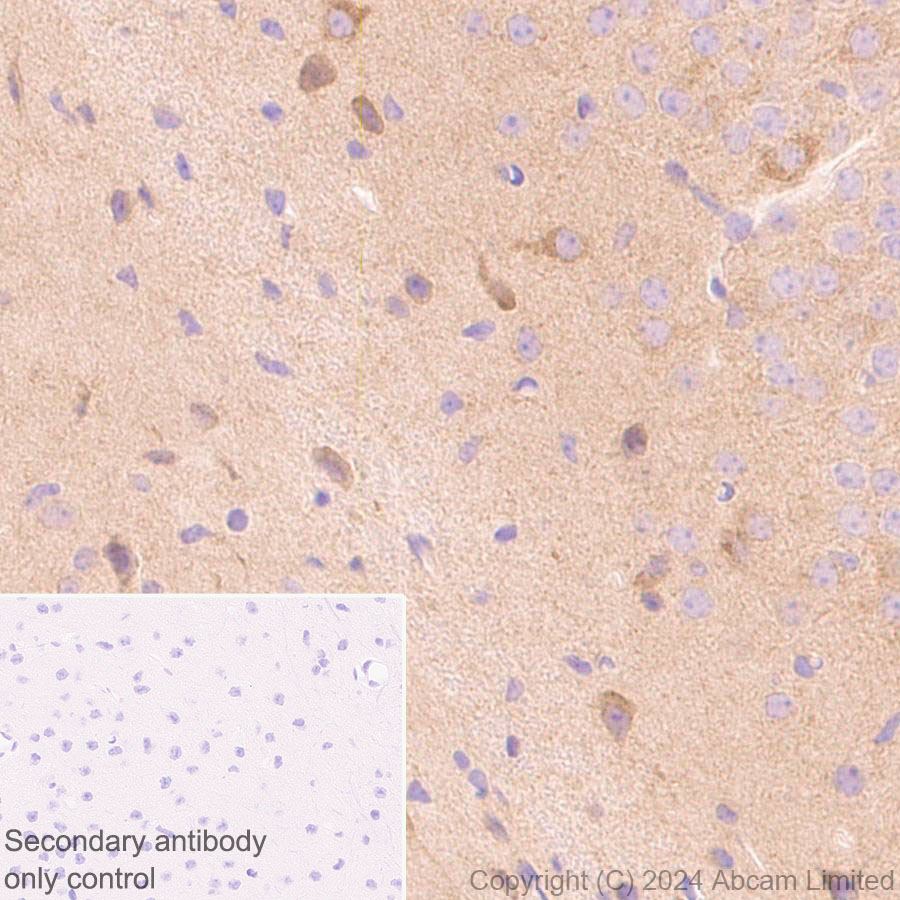 Immunohistochemistry (Formalin/PFA-fixed paraffin-embedded sections) - Anti-TRIM32 antibody [EPR29683-521] (ab322979), expandable thumbnail
