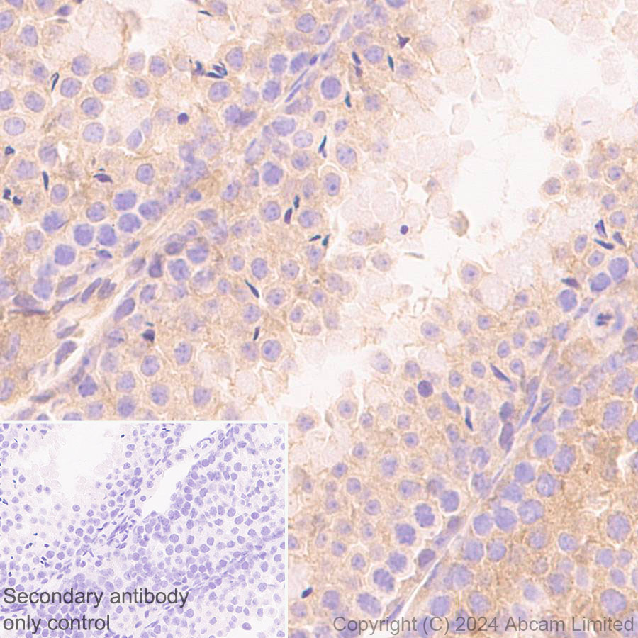 Immunohistochemistry (Formalin/PFA-fixed paraffin-embedded sections) - Anti-TRIM32 antibody [EPR29683-521] (ab322979), expandable thumbnail