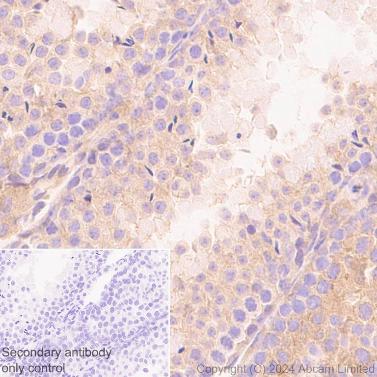 Immunohistochemistry (Formalin/PFA-fixed paraffin-embedded sections) - Anti-TRIM32 antibody [EPR29683-521] (AB322979)
