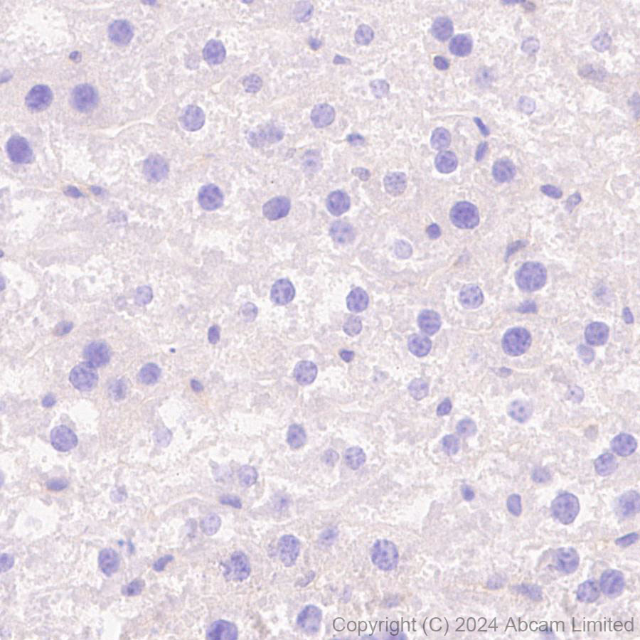 Immunohistochemistry (Formalin/PFA-fixed paraffin-embedded sections) - Anti-TRIM32 antibody [EPR29683-521] (AB322979), expandable thumbnail