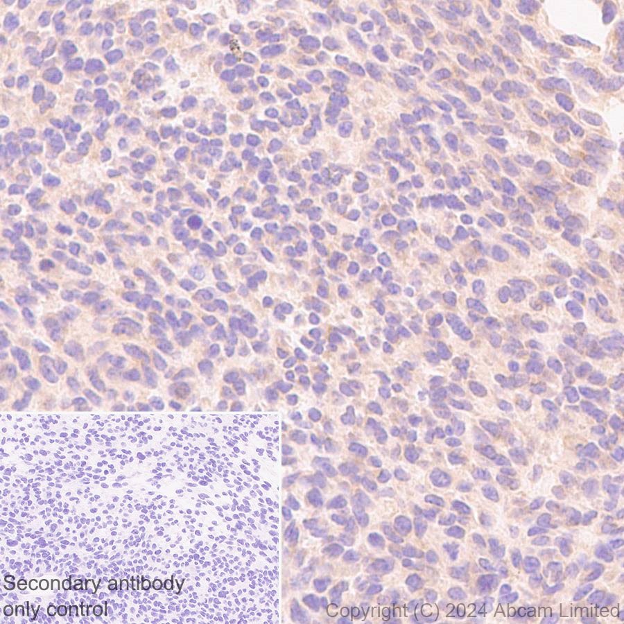Immunohistochemistry (Formalin/PFA-fixed paraffin-embedded sections) - Anti-TRIM32 antibody [EPR29683-521] (AB322979), expandable thumbnail