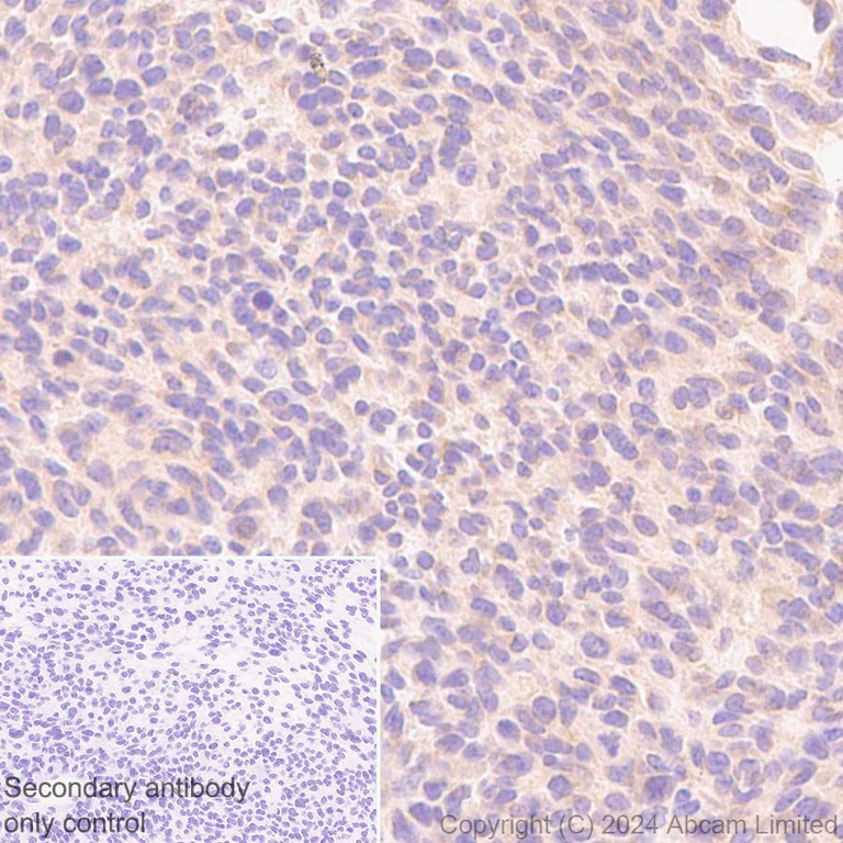 Immunohistochemistry (Formalin/PFA-fixed paraffin-embedded sections) - Anti-TRIM32 antibody [EPR29683-521] (AB322979)