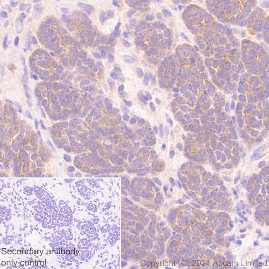 Immunohistochemistry (Formalin/PFA-fixed paraffin-embedded sections) - Anti-TRIM32 antibody [EPR29683-521] (ab322979), expandable thumbnail