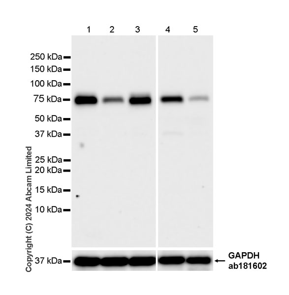 Western blot - Anti-TRIM32 antibody [EPR29683-521] (AB322979), expandable thumbnail