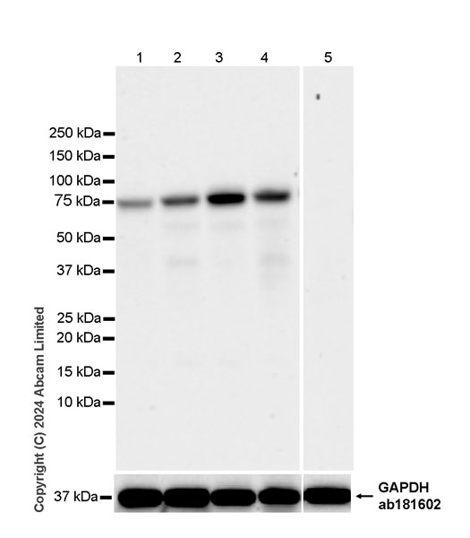 Western blot - Anti-TRIM32 antibody [EPR29683-521] (AB322979), expandable thumbnail