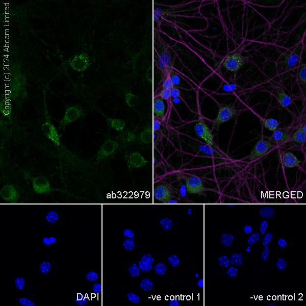 Immunocytochemistry/ Immunofluorescence - Anti-TRIM32 antibody [EPR29683-521] - BSA and Azide free (AB325948)