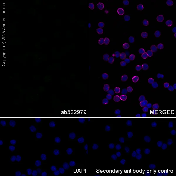 Immunocytochemistry/ Immunofluorescence - Anti-TRIM32 antibody [EPR29683-521] - BSA and Azide free (AB325948)
