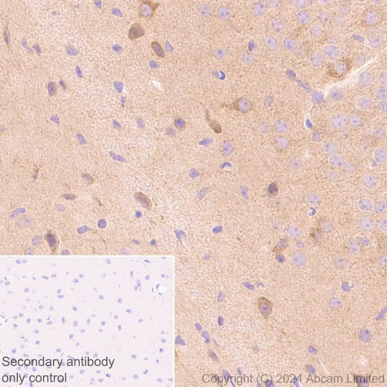 Immunohistochemistry (Formalin/PFA-fixed paraffin-embedded sections) - Anti-TRIM32 antibody [EPR29683-521] - BSA and Azide free (AB325948)