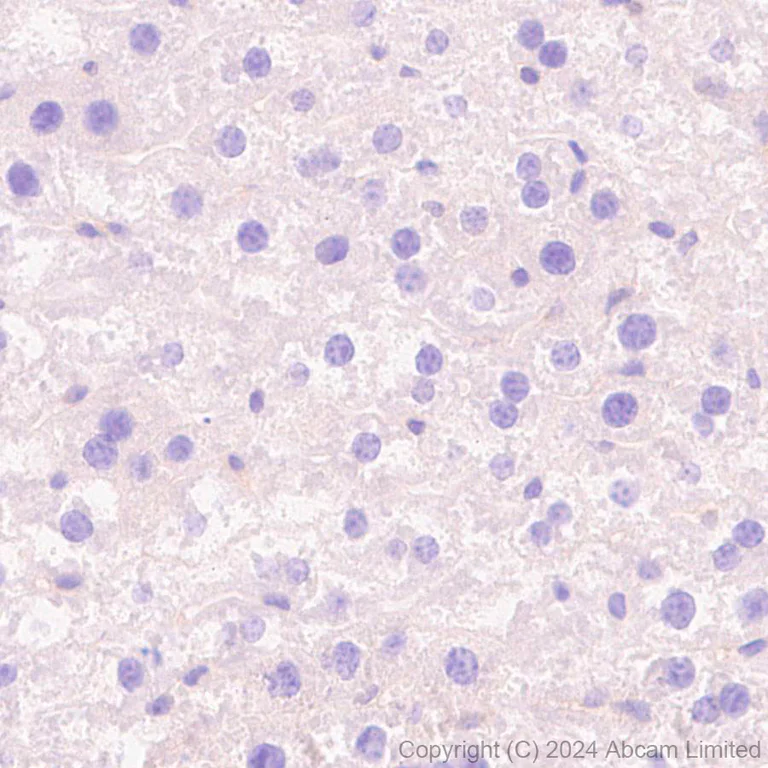 Immunohistochemistry (Formalin/PFA-fixed paraffin-embedded sections) - Anti-TRIM32 antibody [EPR29683-521] - BSA and Azide free (AB325948)