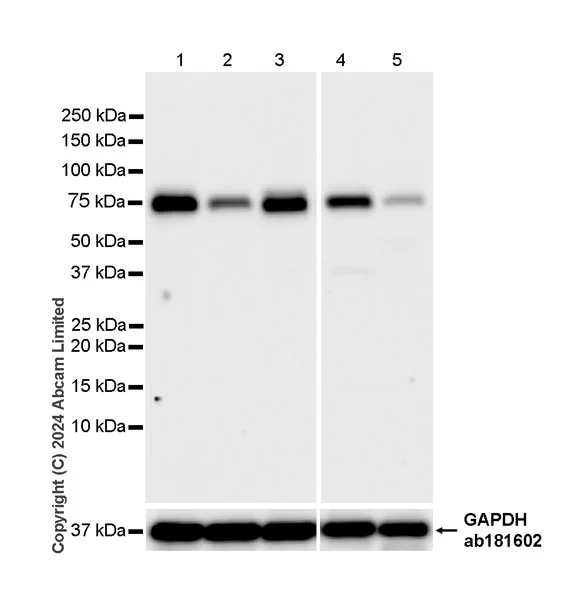 Western blot - Anti-TRIM32 antibody [EPR29683-521] - BSA and Azide free (AB325948)