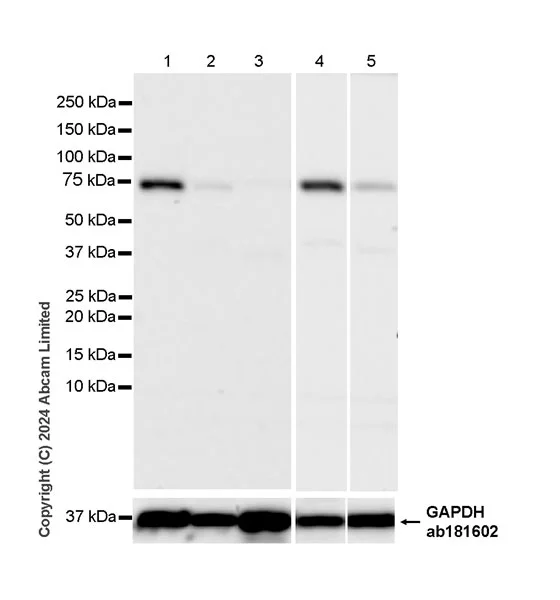 Western blot - Anti-TRIM32 antibody [EPR29683-521] - BSA and Azide free (AB325948)