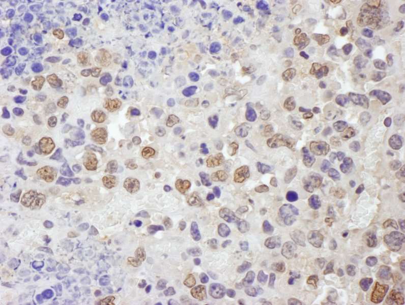 Immunohistochemistry (Formalin/PFA-fixed paraffin-embedded sections) - Anti-TRIM33 antibody (AB264175)