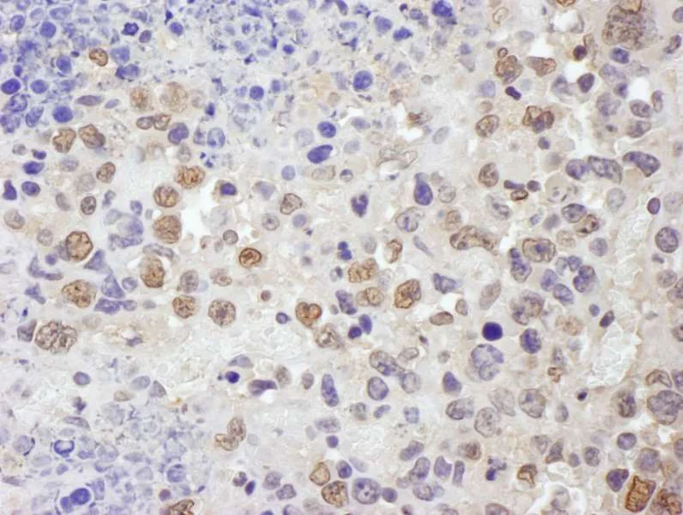 Immunohistochemistry (Formalin/PFA-fixed paraffin-embedded sections) - Anti-TRIM33 antibody (AB264175)