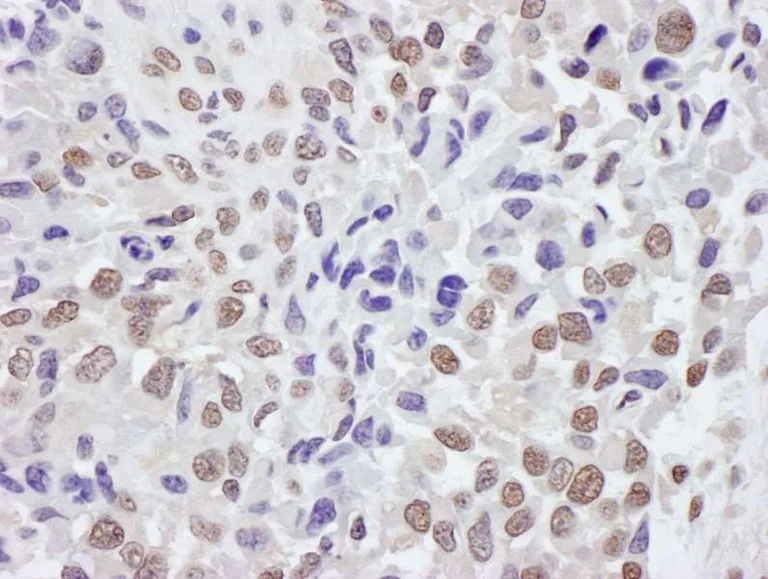 Immunohistochemistry (Formalin/PFA-fixed paraffin-embedded sections) - Anti-TRIM33 antibody (AB264175)