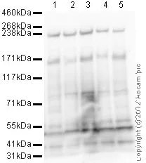 Western blot - Anti-TRIM33 antibody (AB47062)
