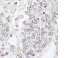 Immunohistochemistry (Formalin/PFA-fixed paraffin-embedded sections) - Anti-TRIM33 antibody (AB84455)