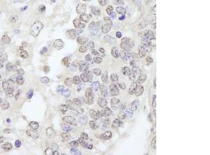 Immunohistochemistry (Formalin/PFA-fixed paraffin-embedded sections) - Anti-TRIM33 antibody (AB84455)