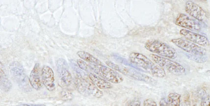 Immunohistochemistry (Formalin/PFA-fixed paraffin-embedded sections) - Anti-TRIM33 antibody (AB84455)