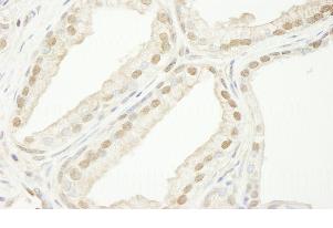 Immunohistochemistry (Formalin/PFA-fixed paraffin-embedded sections) - Anti-TRIM33 antibody (AB84455)