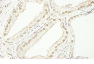 Immunohistochemistry (Formalin/PFA-fixed paraffin-embedded sections) - Anti-TRIM33 antibody (AB84455)