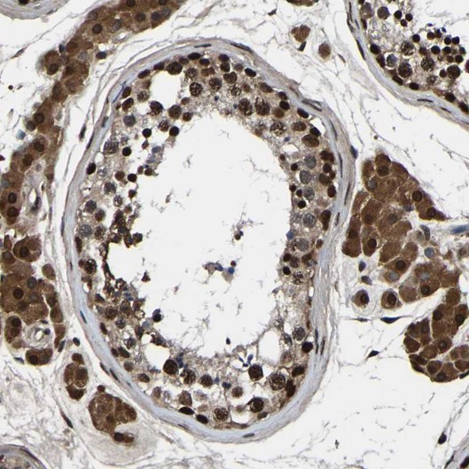 Immunohistochemistry (Formalin/PFA-fixed paraffin-embedded sections) - Anti-TRIM35 antibody (AB272582)