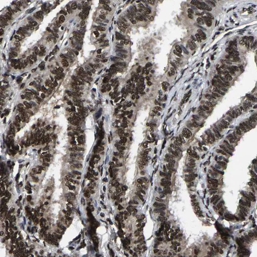 Immunohistochemistry (Formalin/PFA-fixed paraffin-embedded sections) - Anti-TRIM35 antibody (AB272582)