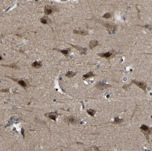 Immunohistochemistry (Formalin/PFA-fixed paraffin-embedded sections) - Anti-TRIM35 antibody (AB272582)
