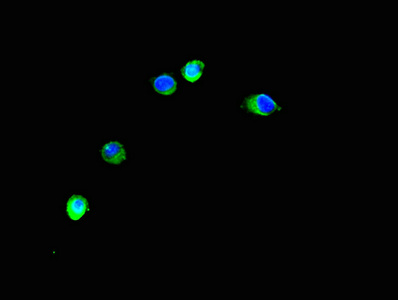 Immunocytochemistry/ Immunofluorescence - Anti-TRIM37/MUL antibody (AB238156)