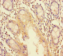 Immunohistochemistry (Formalin/PFA-fixed paraffin-embedded sections) - Anti-TRIM37/MUL antibody (AB238156)