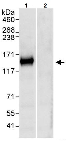 Immunoprecipitation - Anti-TRIM37/MUL antibody (AB264189)