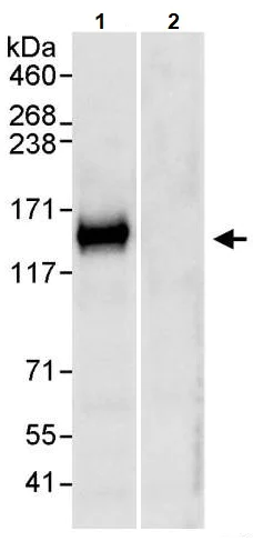 Immunoprecipitation - Anti-TRIM37/MUL antibody (AB264189)