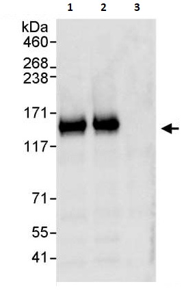 Immunoprecipitation - Anti-TRIM37/MUL antibody (AB264190), expandable thumbnail