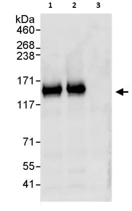 Immunoprecipitation - Anti-TRIM37/MUL antibody (AB264190)
