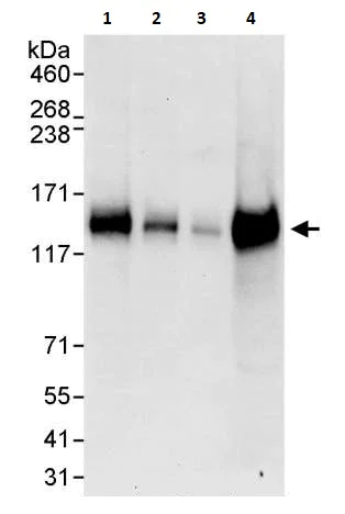 Western blot - Anti-TRIM37/MUL antibody (AB264190)