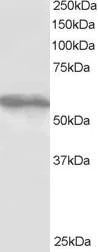 Western blot - Anti-TRIM4 antibody (AB4527)