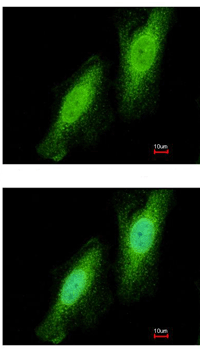 Immunocytochemistry/ Immunofluorescence - Anti-TRIM41 antibody (AB111580), expandable thumbnail