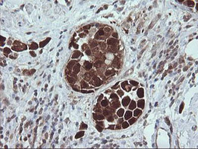 Immunohistochemistry (Formalin/PFA-fixed paraffin-embedded sections) - Anti-TRIM44 antibody [OTI1E10] (AB236422)