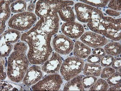 Immunohistochemistry (Formalin/PFA-fixed paraffin-embedded sections) - Anti-TRIM44 antibody [OTI1E10] (AB236422)