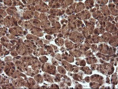 Immunohistochemistry (Formalin/PFA-fixed paraffin-embedded sections) - Anti-TRIM44 antibody [OTI1E10] (AB236422)