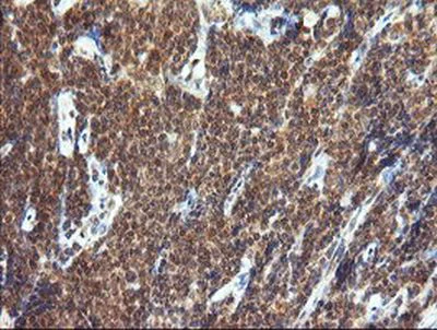 Immunohistochemistry (Formalin/PFA-fixed paraffin-embedded sections) - Anti-TRIM44 antibody [OTI1E10] (AB236422)